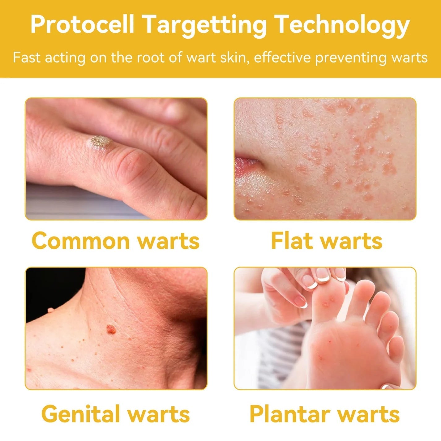 ELITEPRO™ Bee Venom Tag Remover Spray - 30ml : Eliminate Warts & Skin Tags Naturally in Just 1-2 Weeks! 🐝
