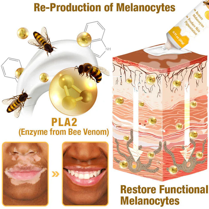 ELITEPRO™ BEE VENOM VITILIGO TREATMENT CREAM