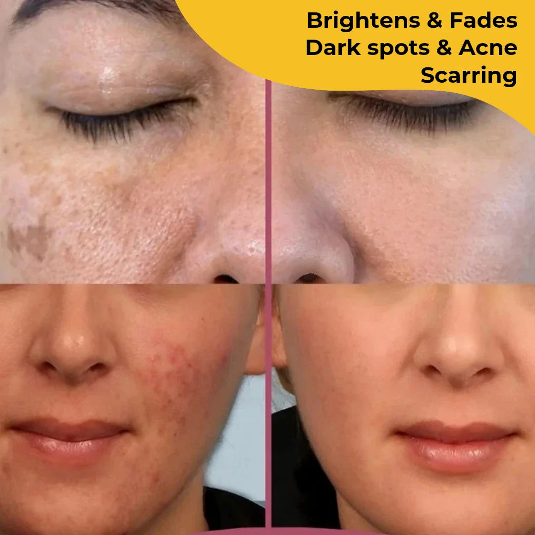 Elite Beauty Turmeric Kojic Acid Pads