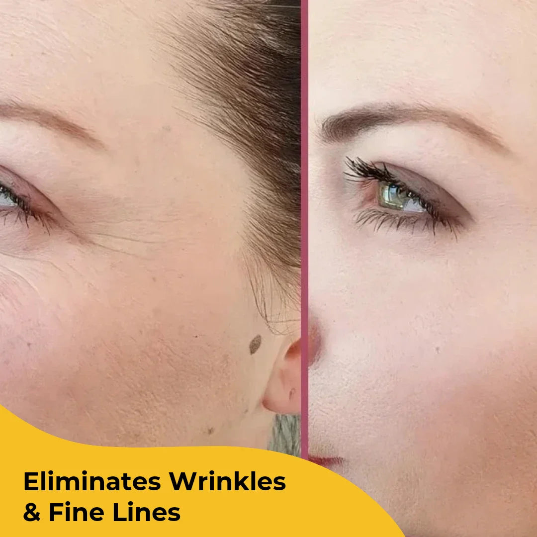 Elite Beauty Turmeric Kojic Acid Pads