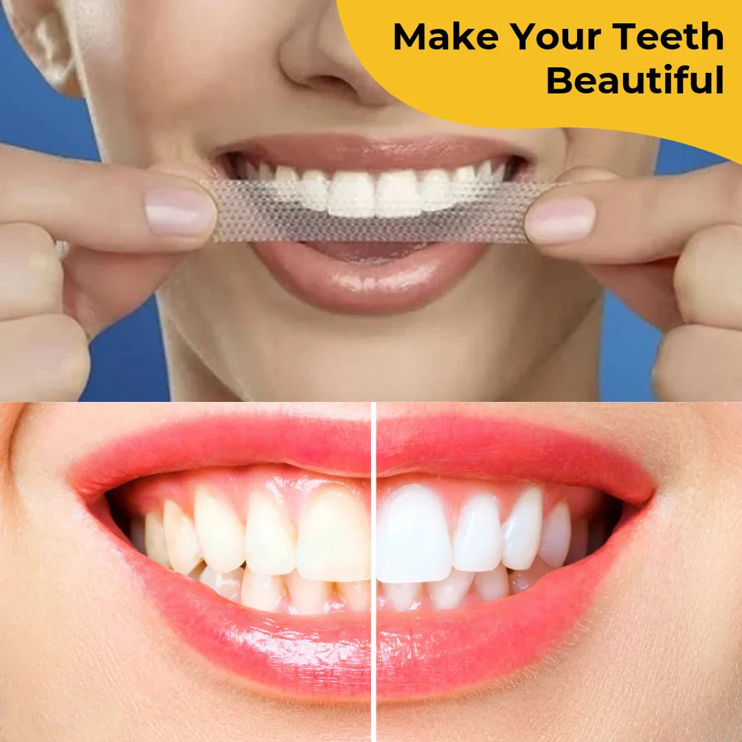 Teeth Whitening Strips