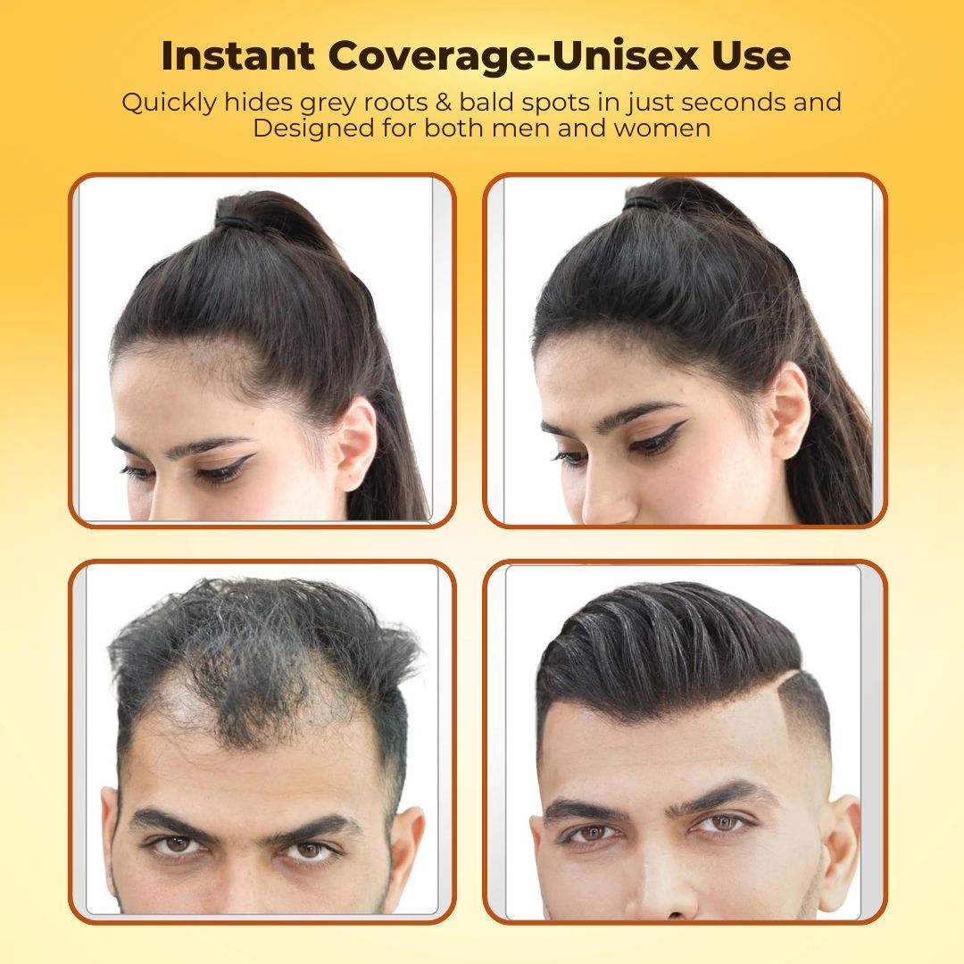 Elite India Hairline Shadow Powder- Works With every skin type: No Harm to your scalp