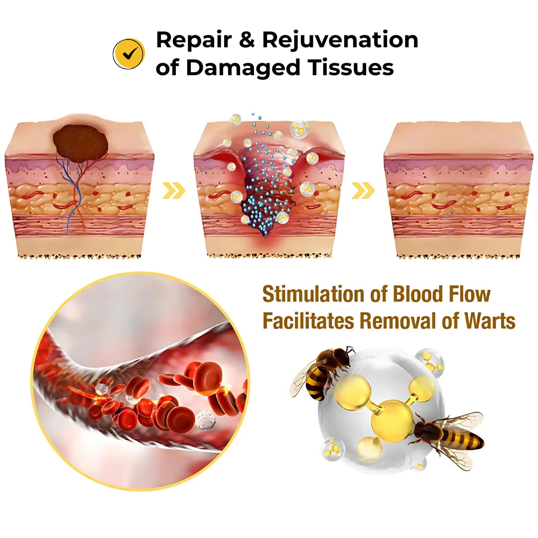 ELITEPRO™ Bee Venom Tag Remover Spray - 30ml : Eliminate Warts & Skin Tags Naturally in Just 1-2 Weeks! 🐝