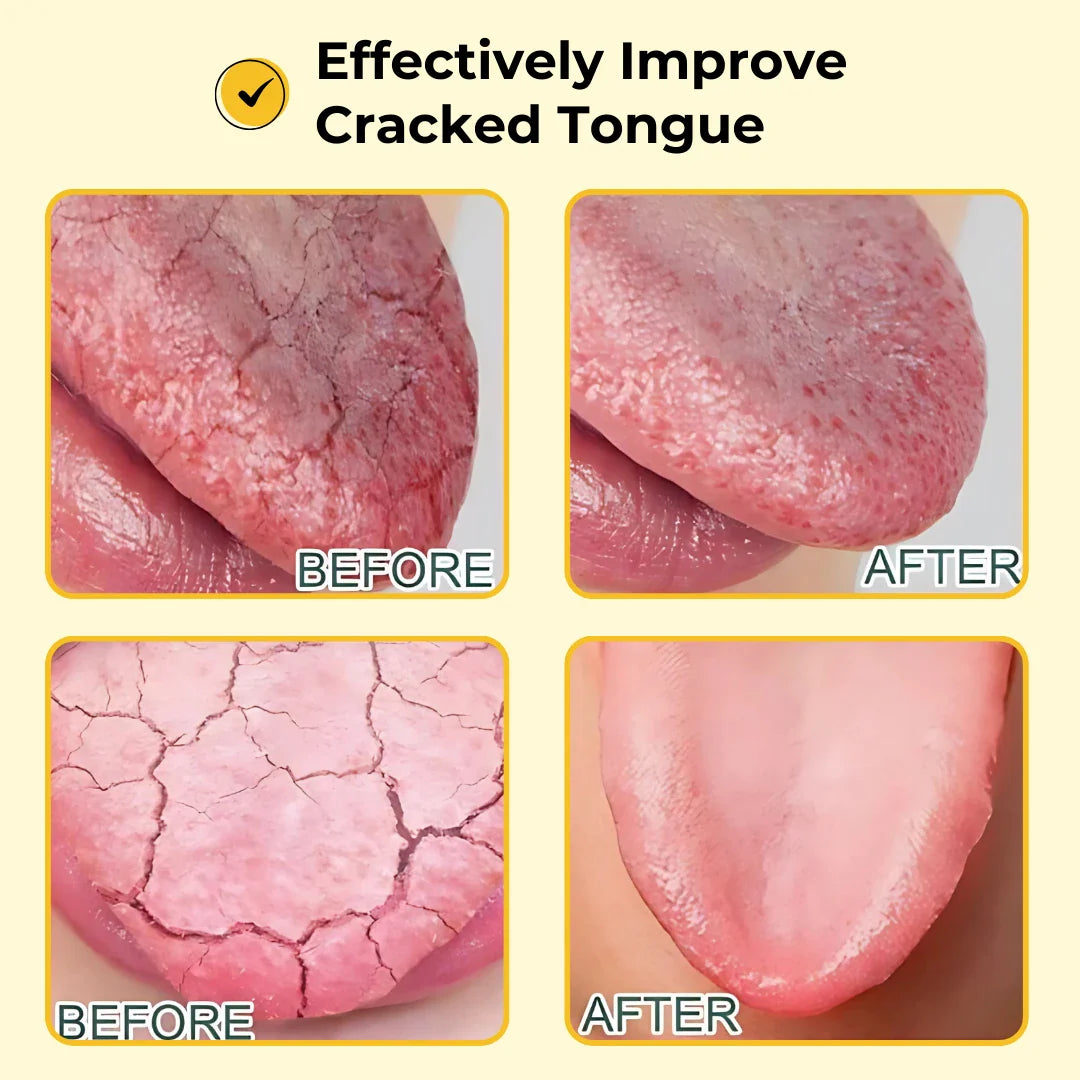 Fresh Breath Essence Breath Care Drop 30ml, Bad Breath Eliminating Serum, Fresh Breath Oral Care Essence, Natural Breath Freshening Drops, With Mint Oil Breath Freshener Bad Breath Eliminating