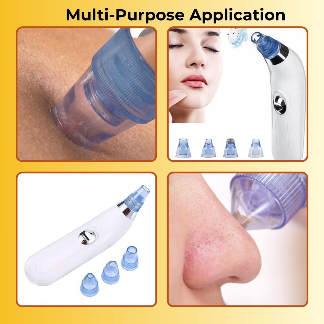 Vacuum Blackhead Remover