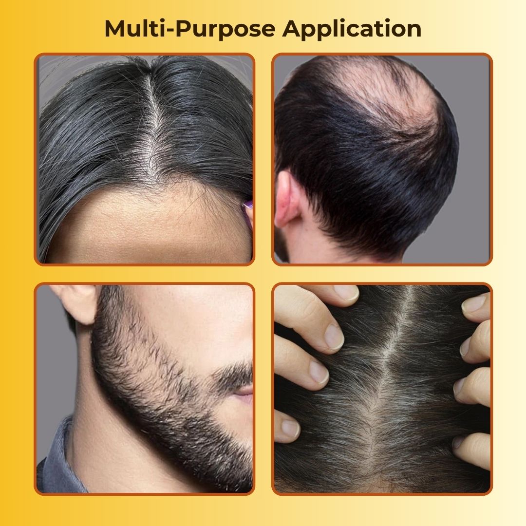 Elite India Hairline Shadow Powder- Works With every skin type: No Harm to your scalp