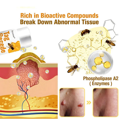 ELITEPRO™ Bee Venom Tag Remover Spray - 30ml : Eliminate Warts & Skin Tags Naturally in Just 1-2 Weeks! 🐝