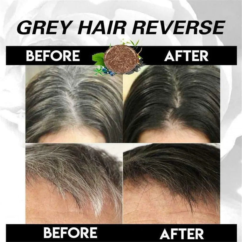 ELITEPRO™ Organic Herbal Grey Reverse Shampoo Bar (Buy 1 Get 1 Free)
