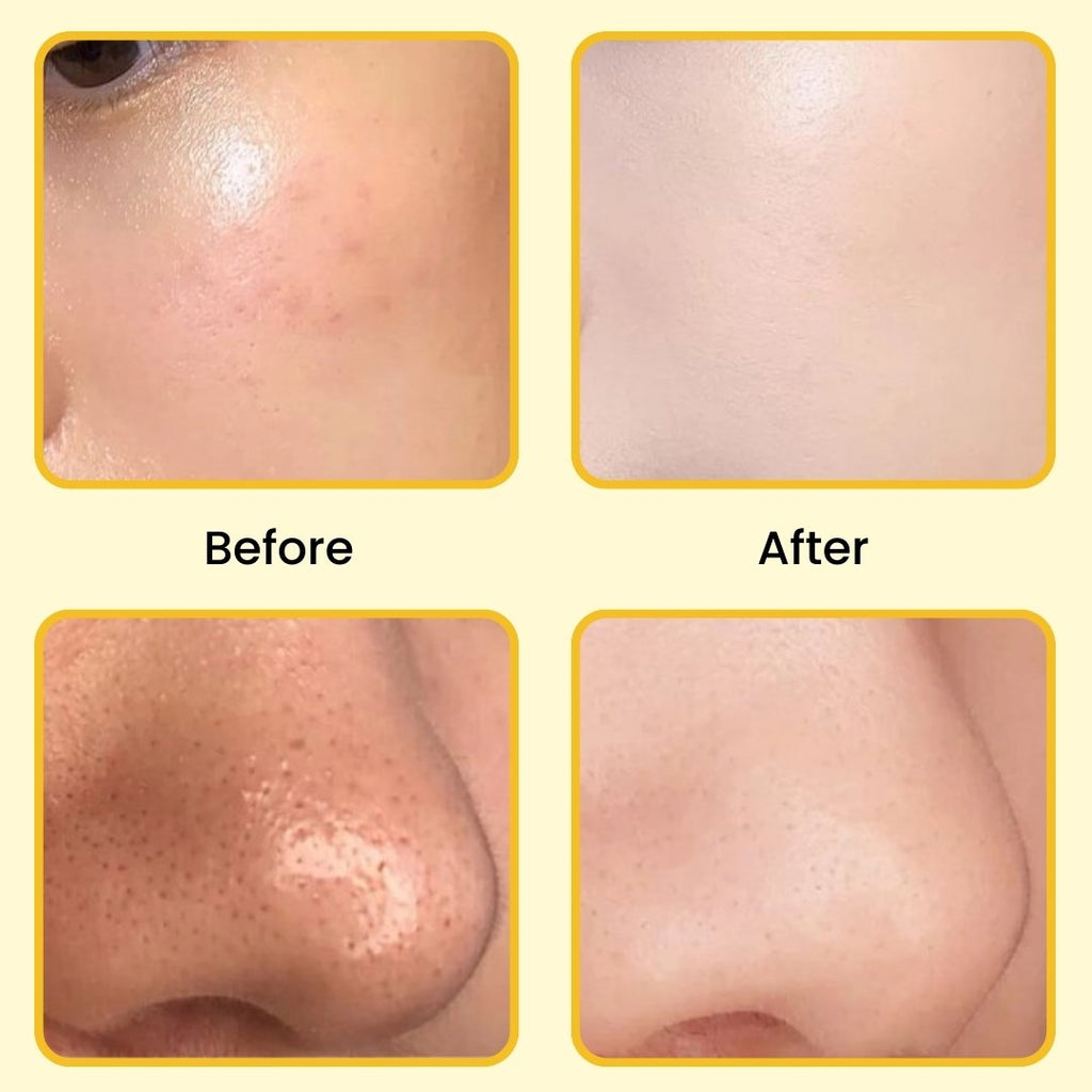 ELITEPRO™ Gold Peel off Mask - Anti-Wrinkle, 98.4% Gold, Anti-Aging, Moisturizing, Removes Blackheads, Reduces Fine Lines, Cleans Pores