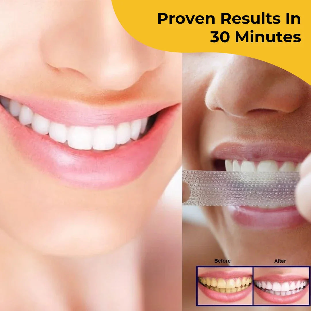 Teeth Whitening Strips