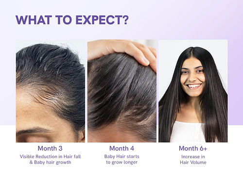 ELITEPRO™ ADVANCED HAIR GROWTH SERUM ROLL ON