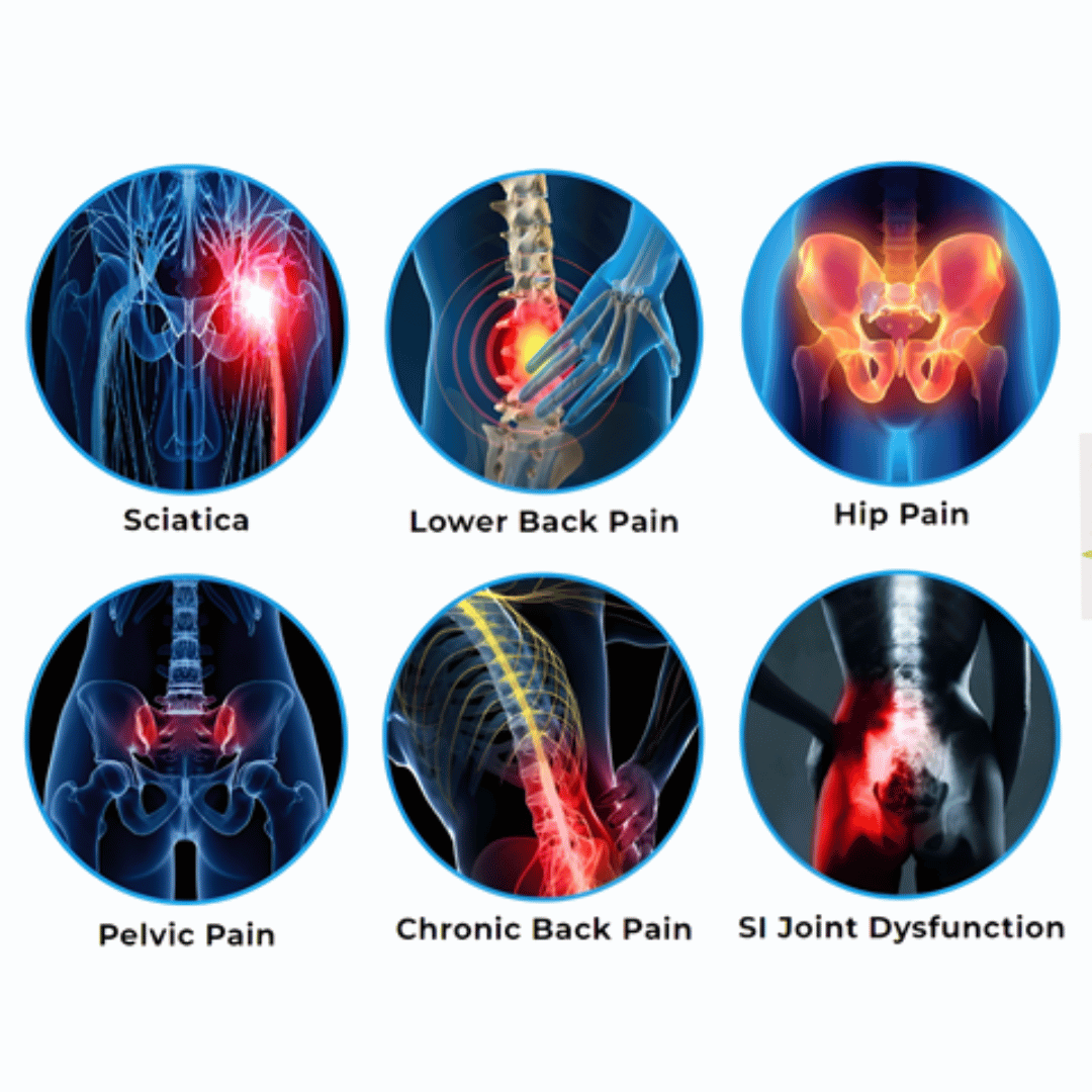 ELITEPRO™ Flexi Pain Relief Back Belt - Relieves Lower Back Pain, Sciatica pain, Improves Posture, Improves Sleep : Medically Approved ✅